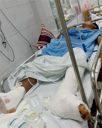 bệnh viện Việt Đức, mổ nhầm chân