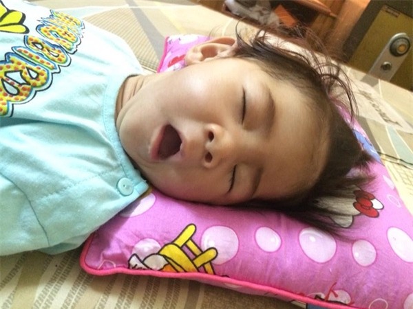 Bé gái 14 tháng tuổi nặng 3,5kg đang tập kích thích cơ và đã tăng lên 6,5kg