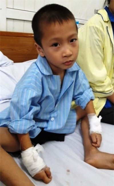 Những vụ mổ nhầm, cắt nhầm tai hại của ngành Y tế - 2