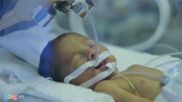 Sáng 14/9, bé Gấu phải trải qua ca cấp cứu đặc biệt. Ảnh: Hoàng Hiệp.