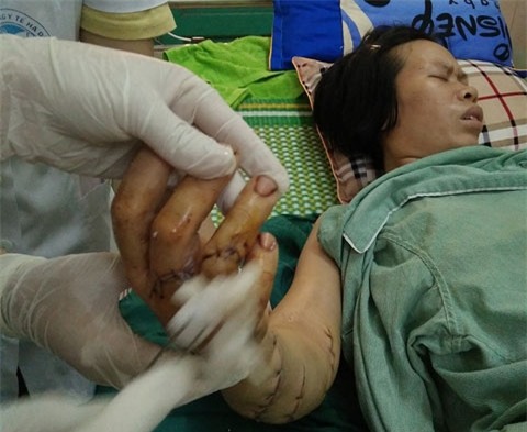 chồng chém vợ, man rợ, bạo hành, gia đình, vợ chồng, con rể