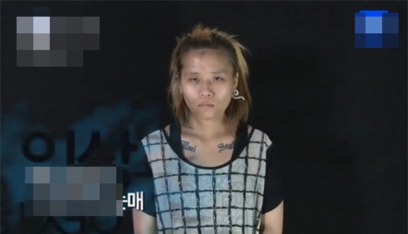 cô gái từng bị tấn công tình dục đẹp lên nhờ thẩm mỹ 0