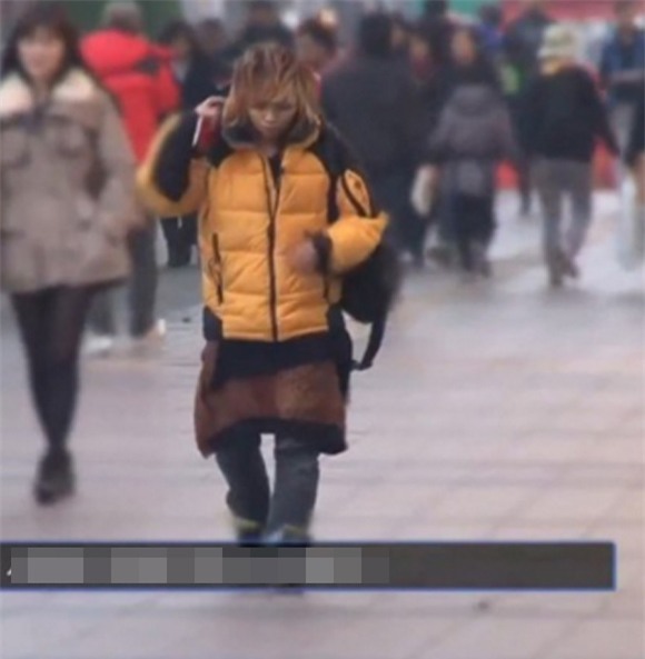 cô gái từng bị tấn công tình dục đẹp lên nhờ thẩm mỹ 9