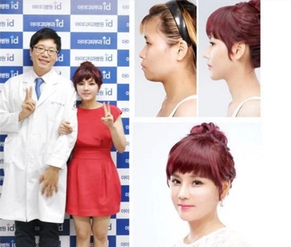 cô gái từng bị tấn công tình dục đẹp lên nhờ thẩm mỹ 10