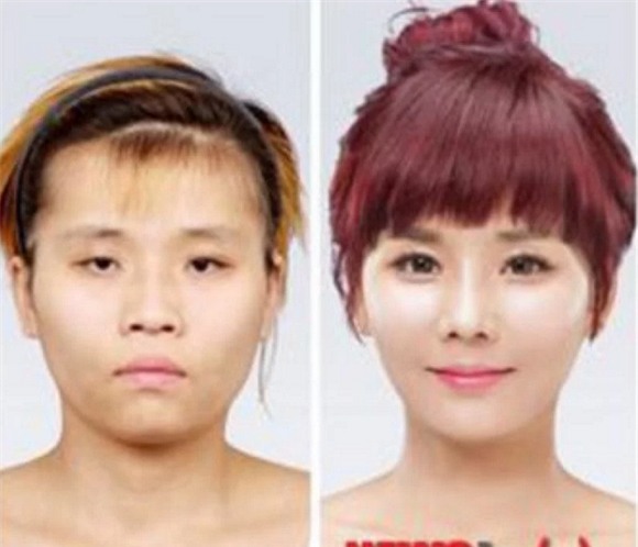 cô gái từng bị tấn công tình dục đẹp lên nhờ thẩm mỹ 12