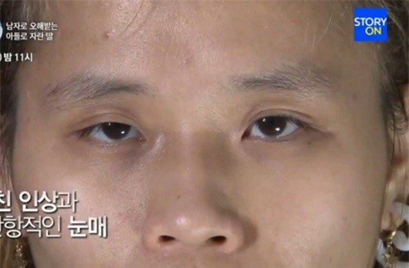 cô gái từng bị tấn công tình dục đẹp lên nhờ thẩm mỹ 1