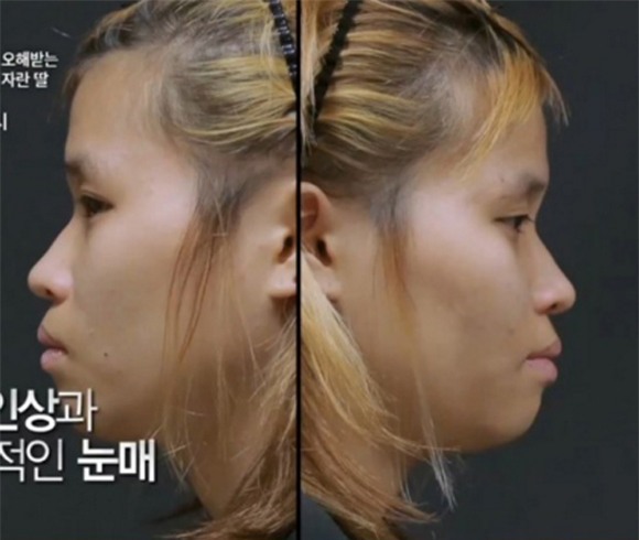 cô gái từng bị tấn công tình dục đẹp lên nhờ thẩm mỹ 2