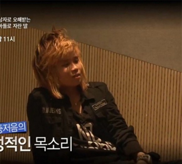 cô gái từng bị tấn công tình dục đẹp lên nhờ thẩm mỹ 3