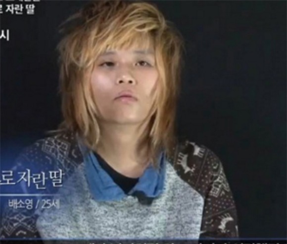 cô gái từng bị tấn công tình dục đẹp lên nhờ thẩm mỹ 5