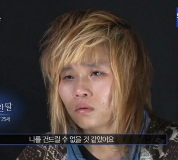 cô gái từng bị tấn công tình dục đẹp lên nhờ thẩm mỹ 6