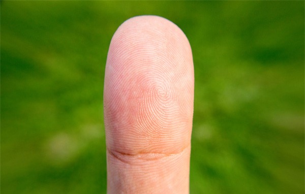 Chỉ cần nhìn tay, bạn sẽ dự đoán được mình có mắc 6 bệnh nguy hiểm này không - Ảnh 3.