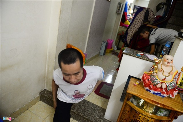 Cap song sinh dinh lien Viet - Duc sau 28 nam mo tach roi hinh anh 8