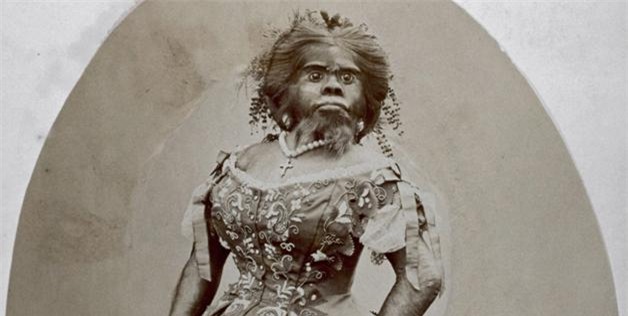 Người phụ nữ xấu nhất thế giới, chết cũng không yên khi bị chồng lôi ra làm vật trưng bày để kiếm tiền - Ảnh 1.