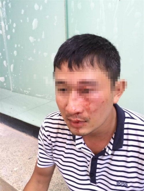 'Đại gia' quỵt 30 ngàn tiền giao hàng và đánh shipper gãy mũi - Ảnh 3