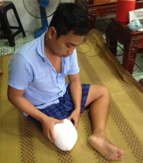 vu benh nhan bi cua chan o tp.hcm: