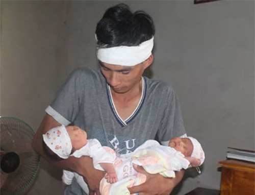 xot thuong cap song sinh vua chao doi da mat me - 1