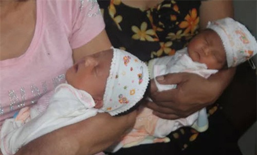 xot thuong cap song sinh vua chao doi da mat me - 2