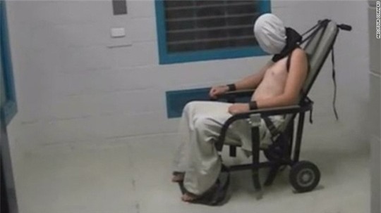 Cậu bé bị tra tấn được phát trên chương trình “Four Corners” của ABC. Ảnh: ABC