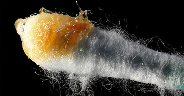 Cơ thể người có 4 tạo vật kinh dị, và sự thật về chúng là gì? - Ảnh 3.