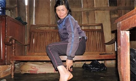 Bắt cóc ép viết giấy nhận nợ: Con gái nạn nhân từng bị cắt chân