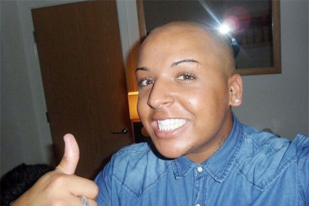 Kim Kardashian, phẫu thuật thẩm mỹ, bơm môi,