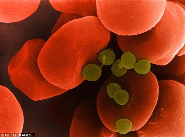 Nhiễm trùng máu: Căn bệnh có thể giết người chỉ sau vài giờ - Ảnh 3.