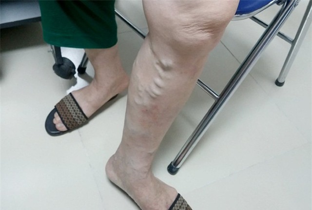 Hàng triệu người Việt mắc bệnh ở chân mà không biết - Ảnh 1.