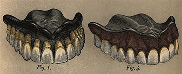 Răng tự phát nổ trong miệng? Câu chuyện có thật ở thế kỷ 19 - Ảnh 4.