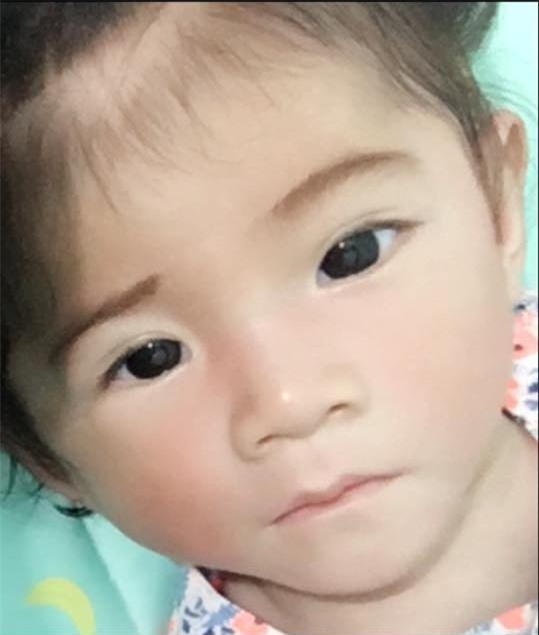 Hành trình kỳ diệu thay da đổi thịt của bé gái 14 tháng tuổi chỉ nặng 3,5kg