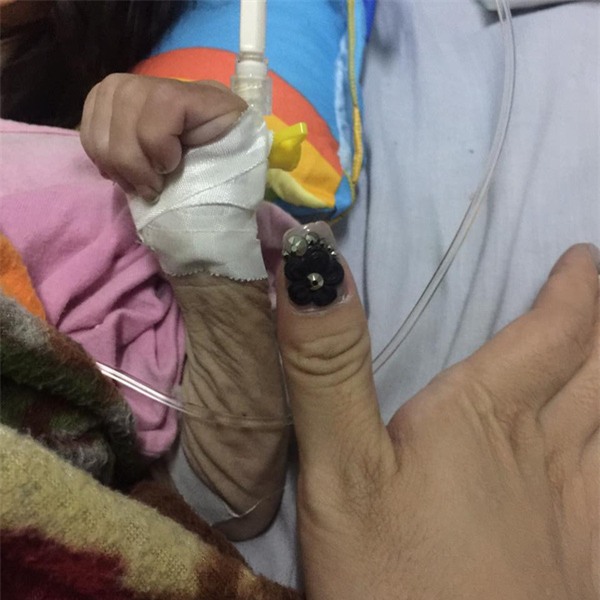 Hành trình kỳ diệu thay da đổi thịt của bé gái 14 tháng tuổi chỉ nặng 3,5kg