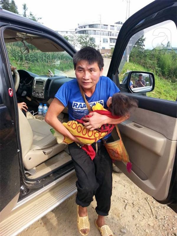 Hành trình kỳ diệu thay da đổi thịt của bé gái 14 tháng tuổi chỉ nặng 3,5kg