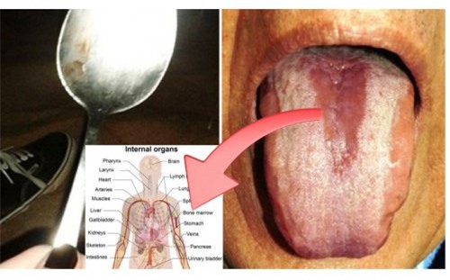 Cách phát hiện nội tạng có đang bị nhiễm độc hay không chỉ bằng 1 chiếc thìa - Ảnh 1.