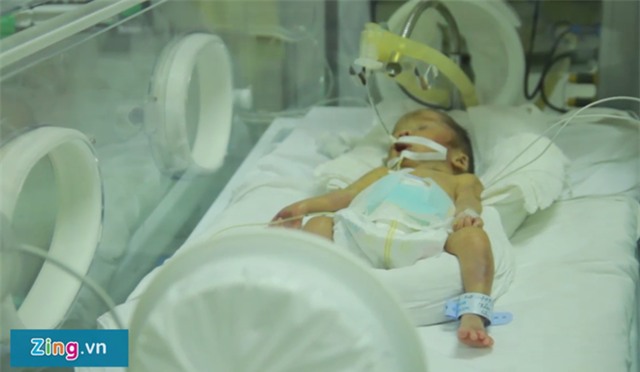 Em be duoc nhuong su song tiep tuc chien dau vi me hinh anh 1