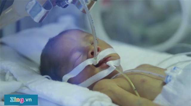 Em be duoc nhuong su song tiep tuc chien dau vi me hinh anh 2