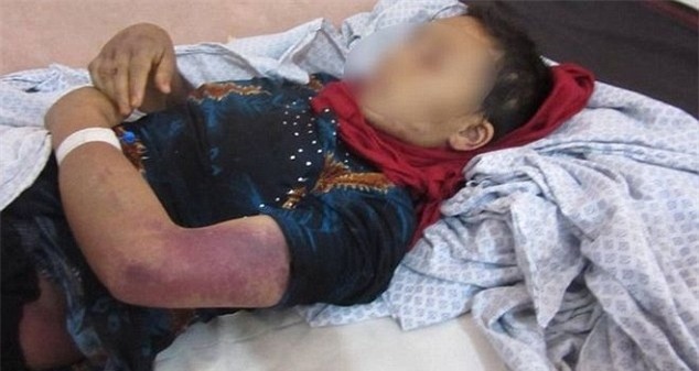 Vợ sảy thai vì bị chồng bạo hành, cắt 'vùng kín'