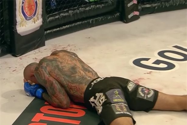Võ sĩ MMA bị đá vỡ sọ thoát khỏi lưỡi hái tử thần - Ảnh 3.