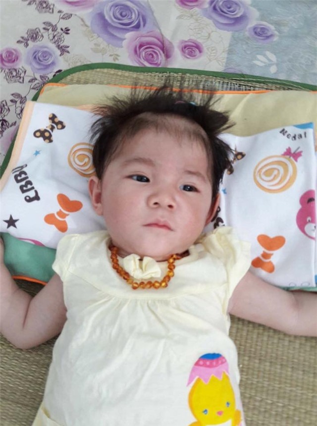 thong tin moi nhat ve em be 14 thang nang 3,5kg o lao cai hinh anh 2