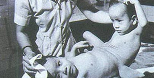 Tiết lộ chấn động và đau đớn về tình mẫu tử của người em trong ca song sinh nổi tiếng VN