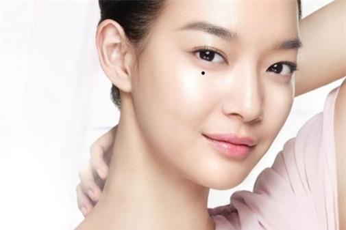 not-ruoi-khac-chong-blogtamsu1