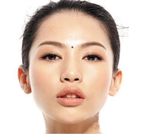 not-ruoi-khac-chong-blogtamsu2