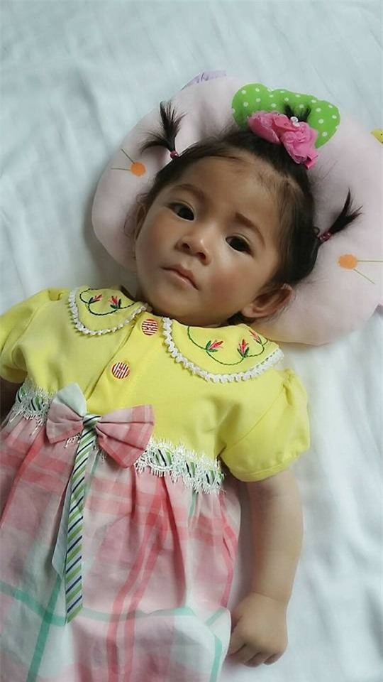 hinh anh be 14 thang nang 3,5kg sau 1 thang dieu tri, cham soc hinh anh 6