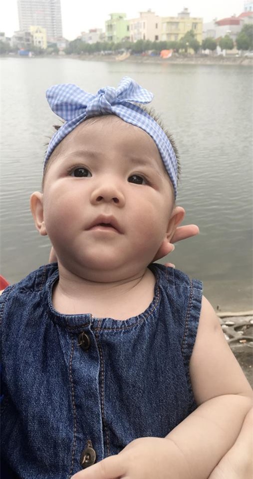 hinh anh be 14 thang nang 3,5kg sau 1 thang dieu tri, cham soc hinh anh 1