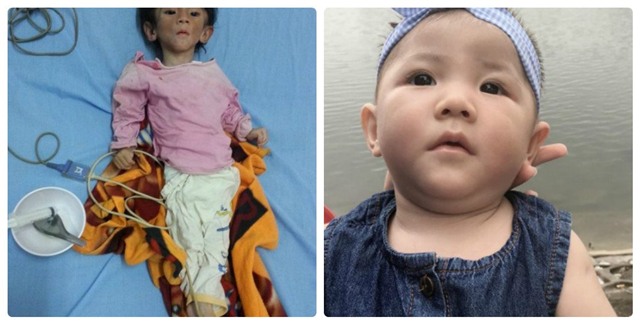 hinh anh be 14 thang nang 3,5kg sau 1 thang dieu tri, cham soc hinh anh 5