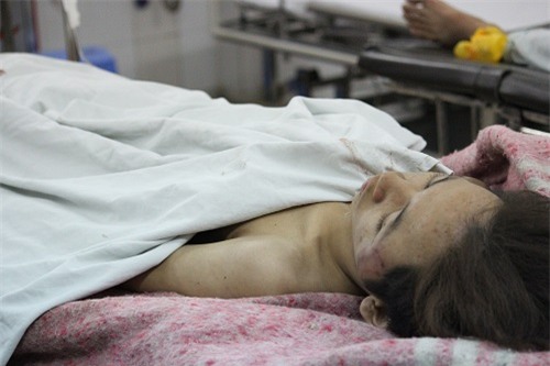 nan nhan vu sap nha rat hoang loan, co bieu hien 'hoi chung vui lap' - 1