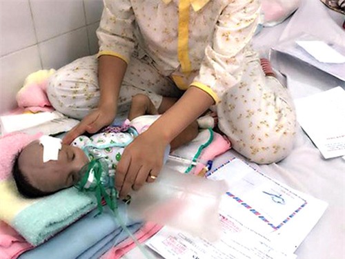 sieu am thai nhi binh thuong, nhung con sinh bi di tat, bien doi cau truc khuon mat - 1