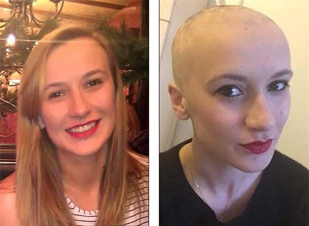 rụng tóc, trụi tóc, thi cử, căng thẳng, sức ép, nữ sinh