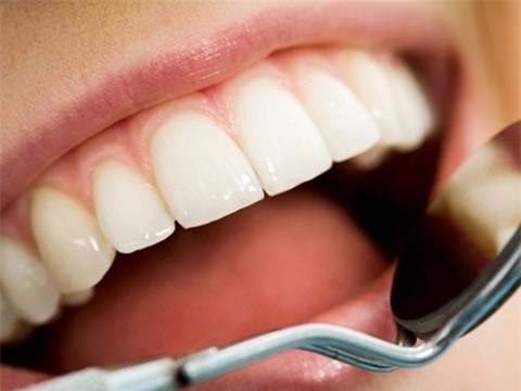 Cao răng là loại chất lắng cặn cứng của muối vô cơ gồm canxi carbonat và phosphate. 
