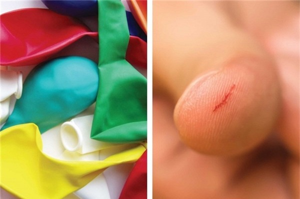 Bạn bị đứt tay và ngại nhúng tay vào nước, nhưng vẫn phải rửa bát, giặt giũ… Vậy làm sao đây? Hãy cho ngón tay bị thương vào một cái bong bóng (chưa bị thủng), vậy là ngón tay của bạn sẽ được bảo vệ khỏi nước.