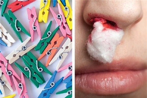 Có vẻ khôi hài, nhưng kẹp quần áo có thể giúp chúng ta chữa chảy máu cam đấy.Bạn ngồi thẳng và ngãđầu ra sau, dùng một cái kẹp quần áo để kẹp mũi lại trong ít nhất 10 phút, bạn sẽ hết chảy máu cam.