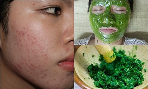 seo lom mo di trong thay chi voi 2 ngan dong rau ma - 5